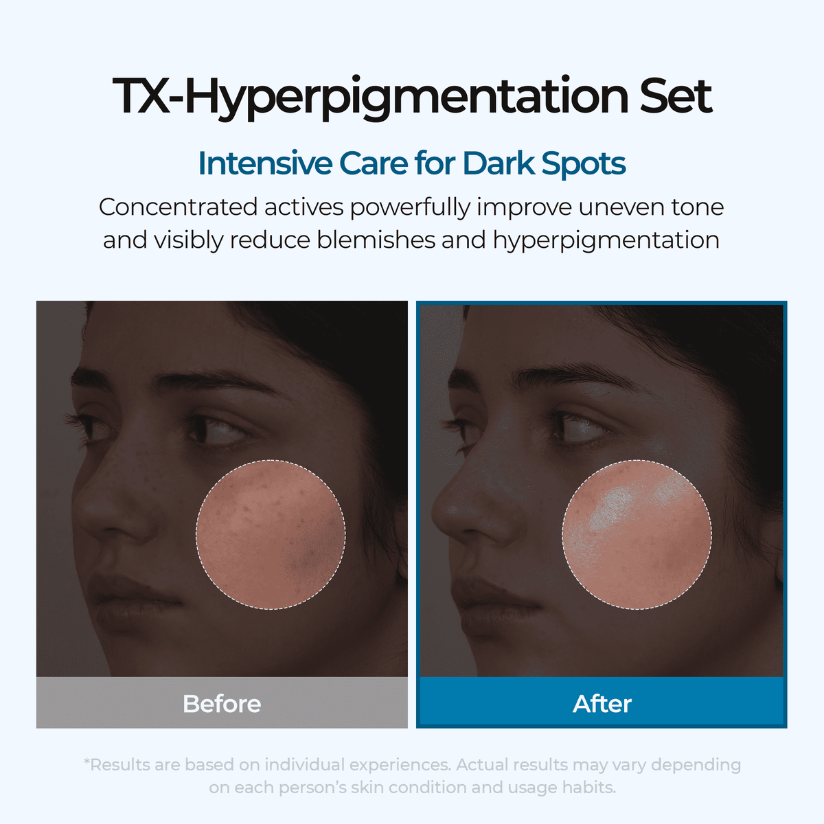 Dark Spot & Uneven Tone Peel Shot TX Duo - image 3