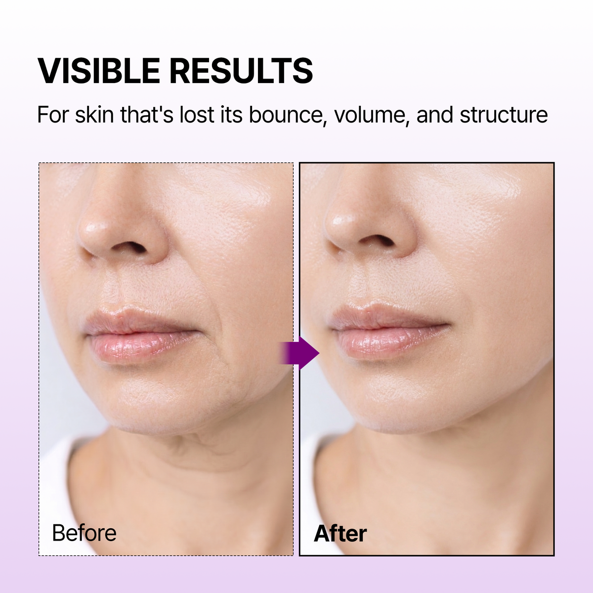 Calcium Bonding Serum & Cream Duo - image 4